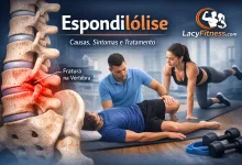 Espondilólise: O Que É, Sintomas, Tratamento e Treino Seguro Para Fortalecer a Lombar